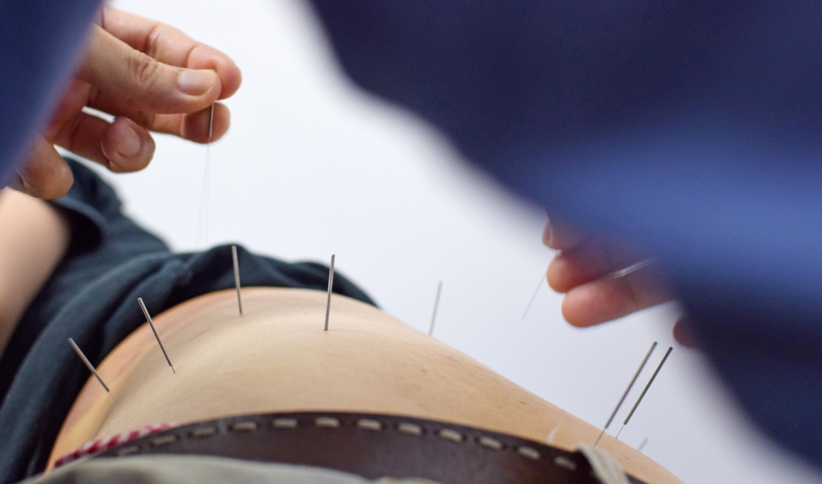 I Got Cheapo Acupuncture—Here’s What Happened’ I Got Cheapo Acupuncture—Here’s What Happened’ new pics I Got Cheapo Acupuncture—Here’s What Happened’ I Got Cheapo Acupuncture—Here’s What Happened’ new pictures